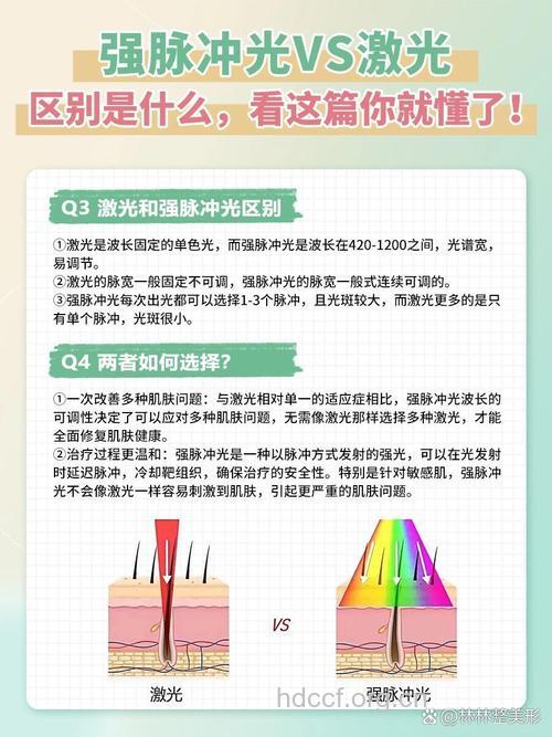 光子嫩肤和激光美容有哪些区别