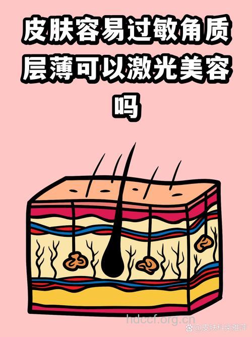激光美容会让皮肤变敏感吗