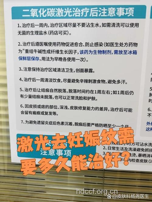 激光去妊娠纹好吗 注意这4点