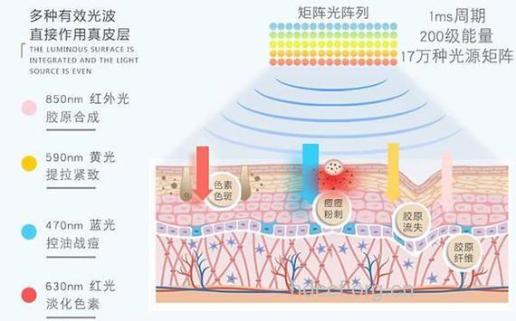 光子去除色素斑的原理