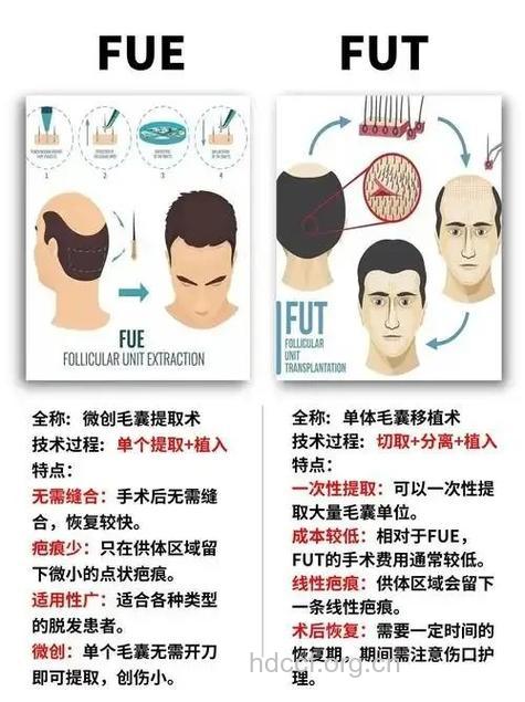 头发掉的太多 还可以进行头发种植吗