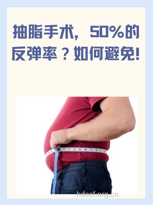 吸脂能减重吗 会不会反弹