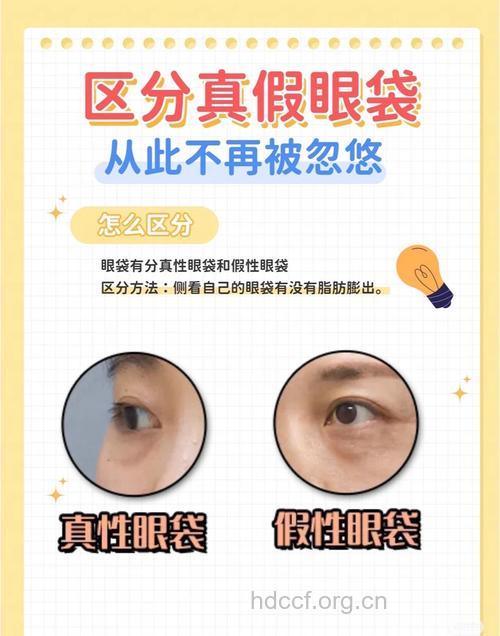 怎么判断自己是否有眼袋方法