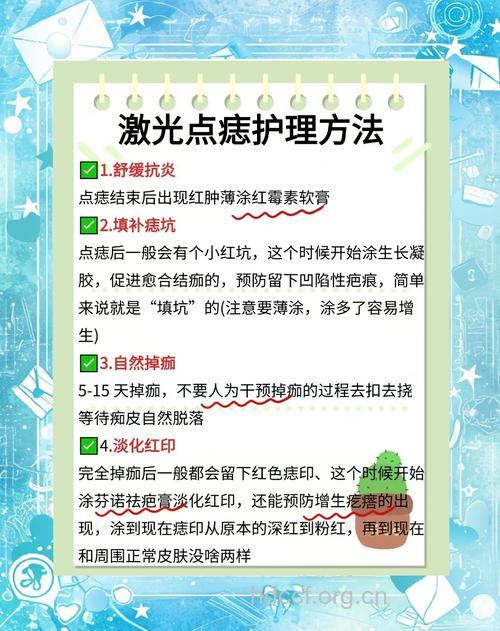 你是适合光子点痣的人群吗