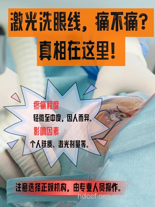 激光洗眼线有风险吗