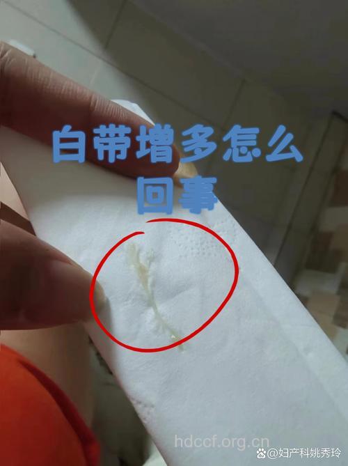 这5种情况下白带增多属于正常