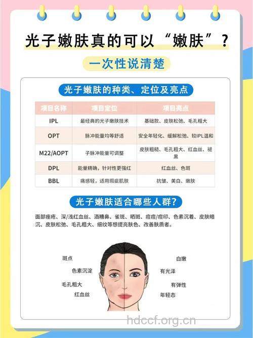 激光美容的优势 你心动了吗