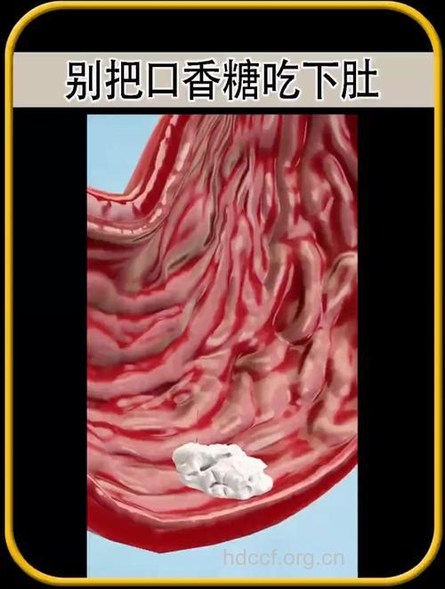不小心吞下口香糖有什么后果