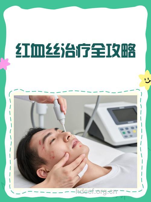 激光去红血丝 别忽视三误区