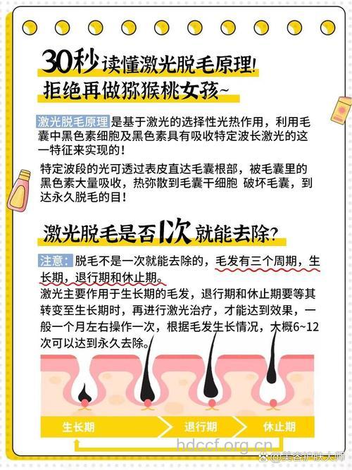 盘点激光脱毛常见五大疑问