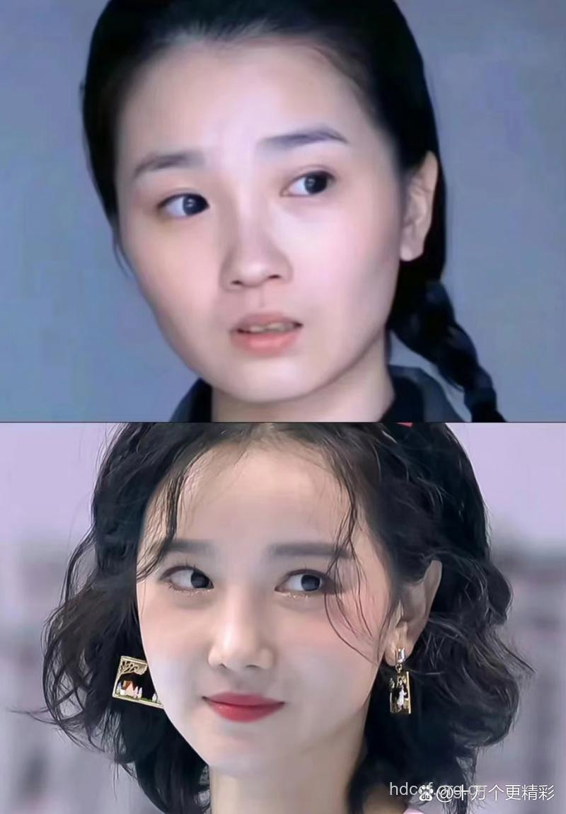 娱乐圈的整形风