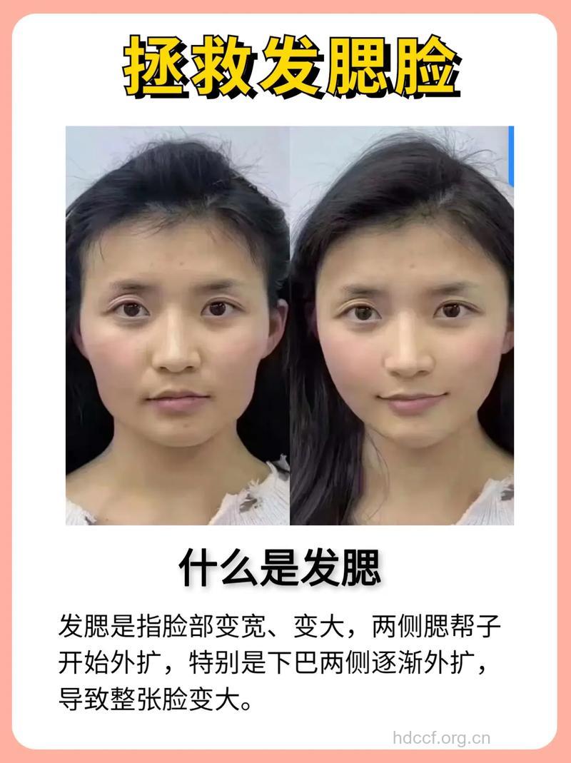 为何会有大饼脸 3个方法让你拥有鹅蛋脸