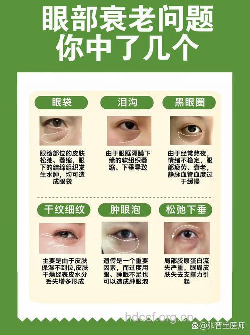 眼部整形最关心的六个问题