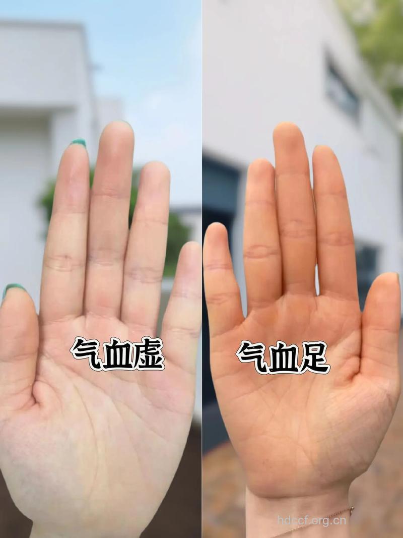 气血不足 女性早衰的凶手