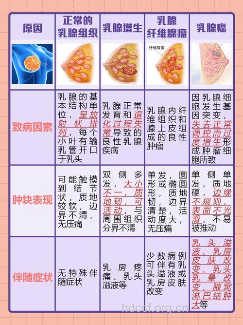 3个症状提示乳腺增生的到来