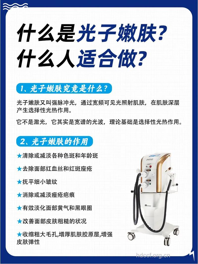 什么是光子嫩肤?