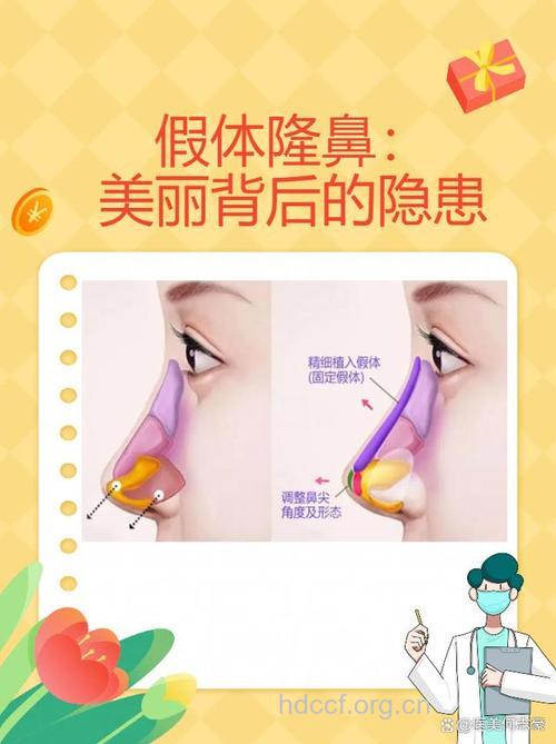 什么是硅胶隆鼻手术