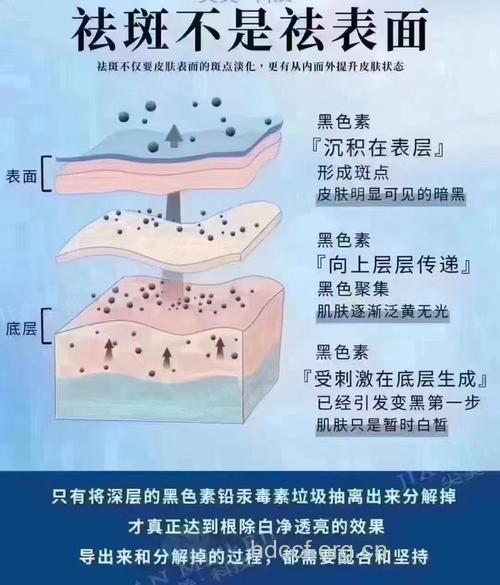 祛斑 激光祛斑的原理