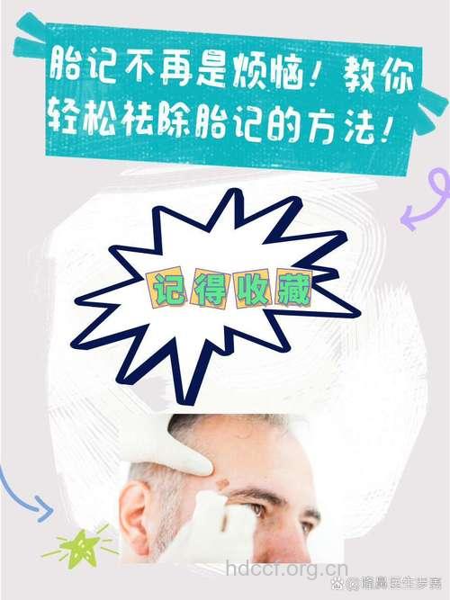 你知道有哪些除胎记方法