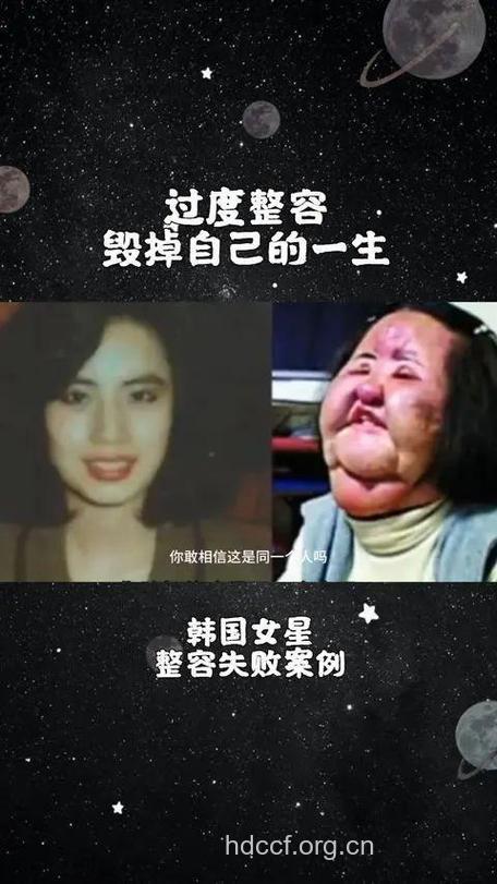 整形!令人担忧的几件事