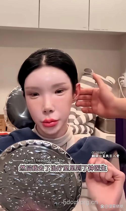 “整容癖”你不知道的整容心理学