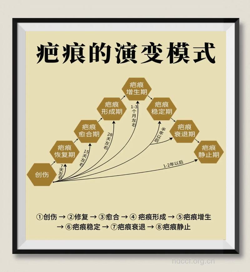 疤痕移植术前术后的注意事项