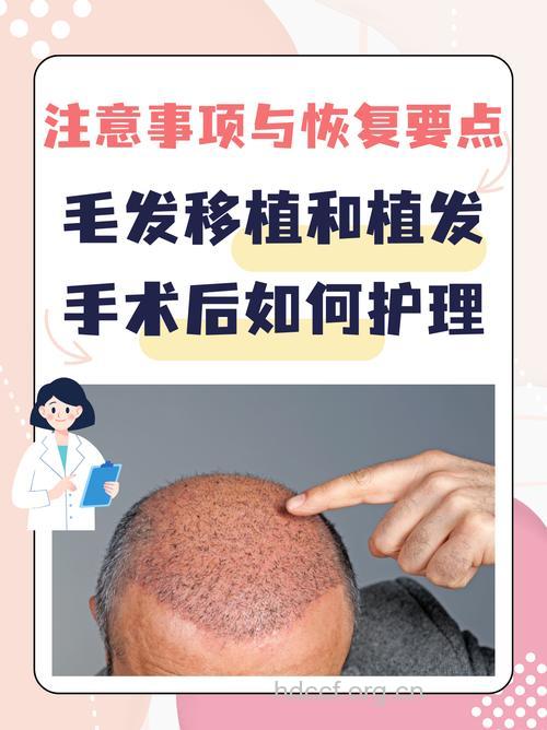 毛发移植术后护理方法