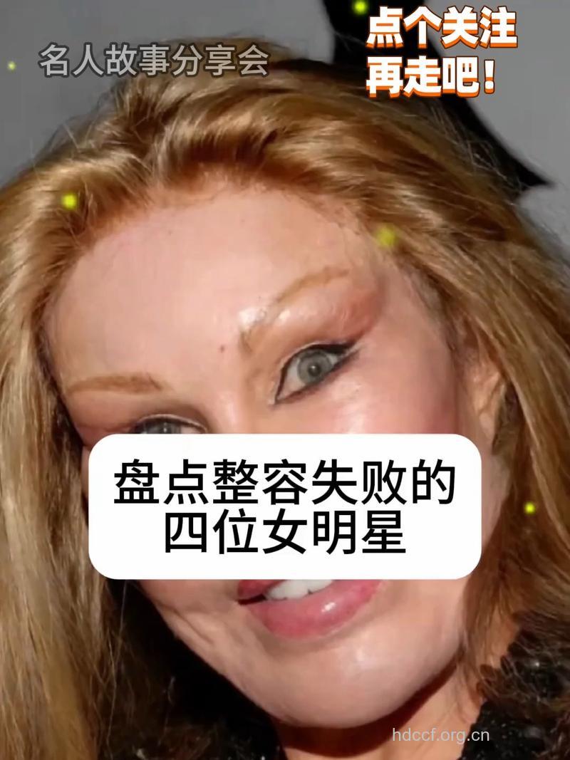 整形美女有哪些想法是错误的