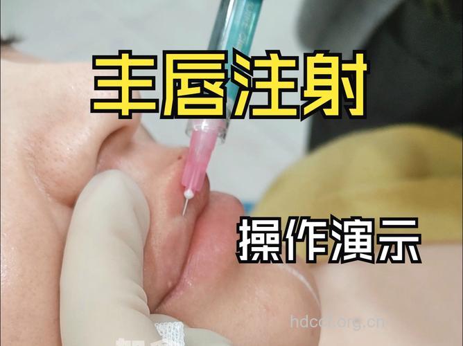 揭秘自体脂肪丰唇手术的6大步骤