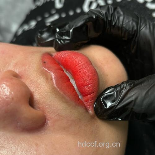 漂唇能达到什么效果 会有危害吗