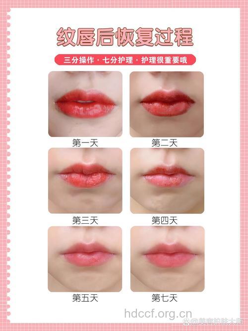 揭秘：唇部整形需要多长时间恢复