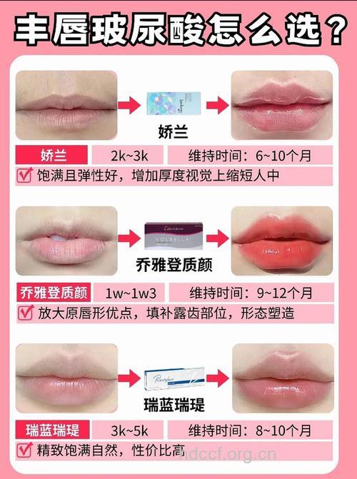 丰唇术适合哪些人群