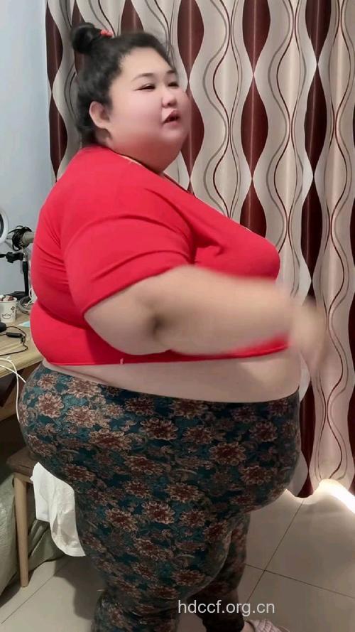 亚洲最胖女子狂减400斤 哪些人适合手术减肥