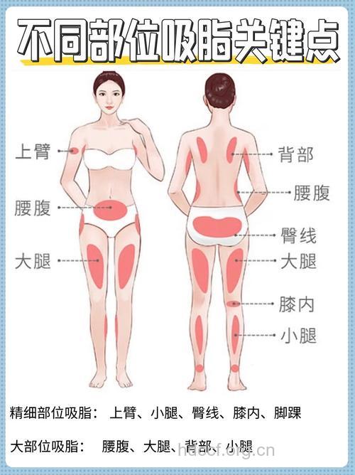 吸脂瘦腿的部位