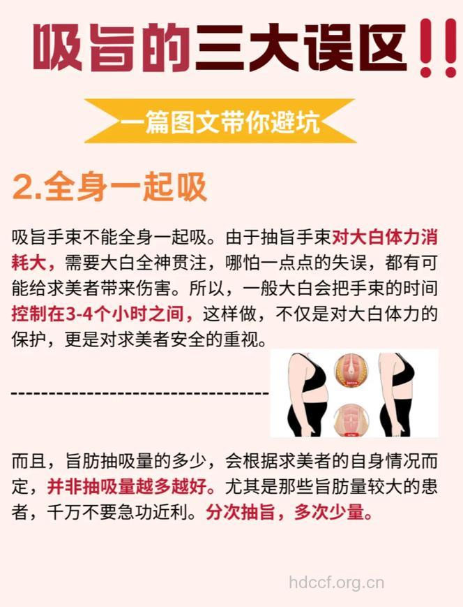 吸脂有哪些误区