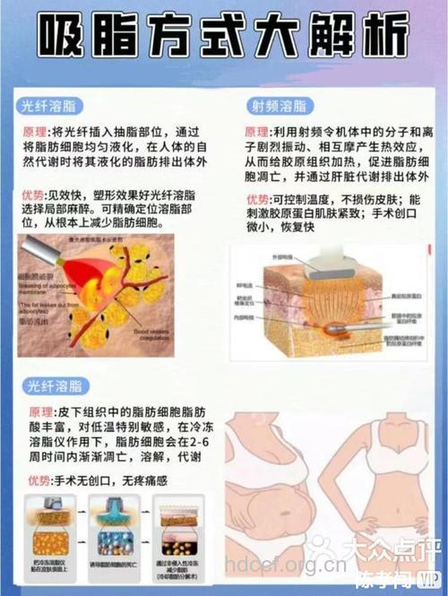 常见的吸脂有哪些方法