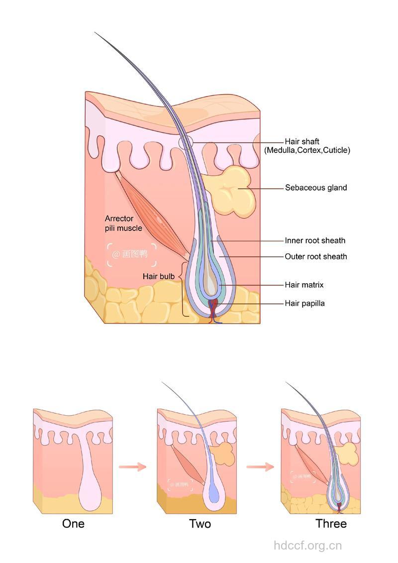 怎么选择毛发移植的供体部位