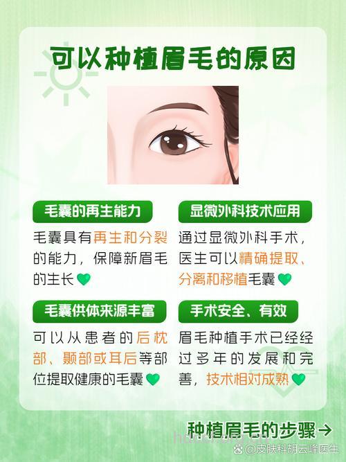 眉毛种植术有哪些注意事项