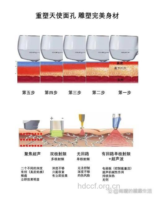 射频紧肤有哪些好处