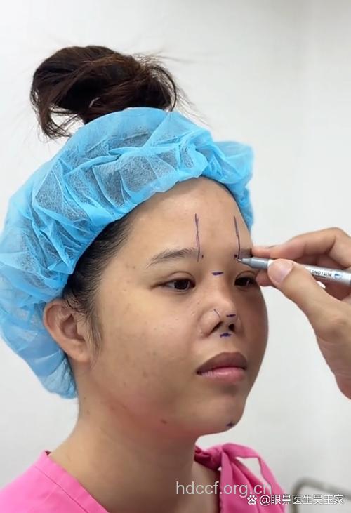 花5万整出歪鼻子 整形需谨慎