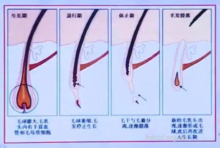 常见的毛发移植部位