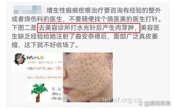 医美行业事故频发 医学美容有何风险