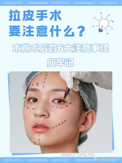 什么是黄金三角拉皮术