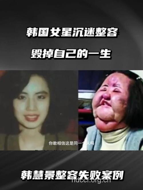 女子赴韩整容遭拒 揭微整形的六大风险