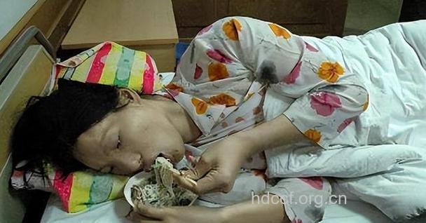 世界最胖女子去世 心肾衰竭而亡