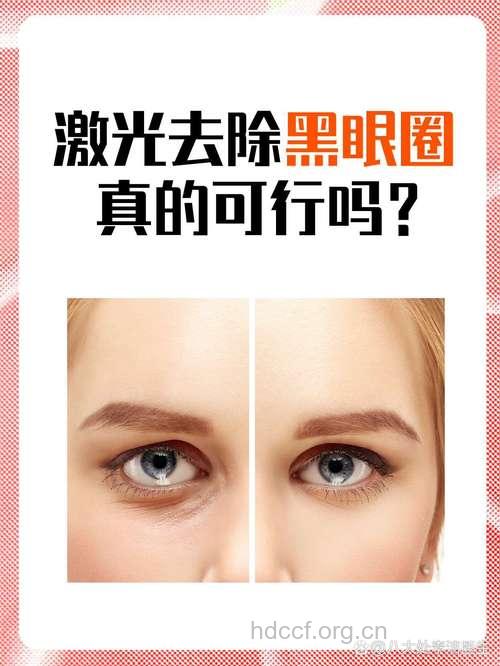 激光居然也能去黑眼圈？
