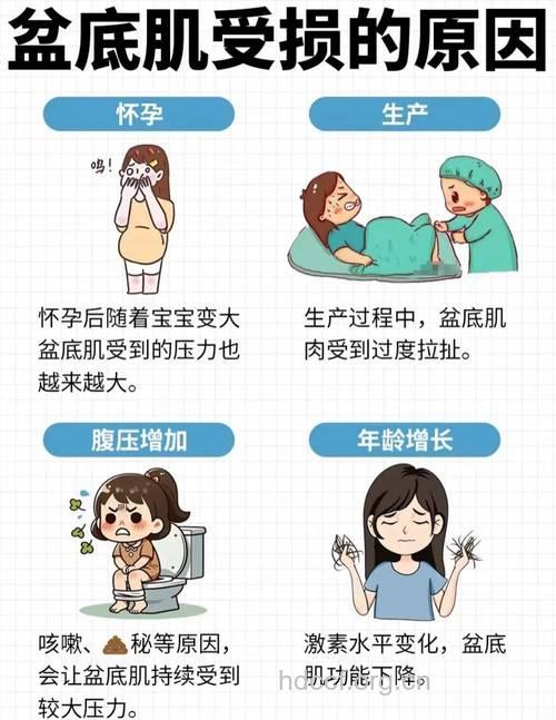产后妈妈如何应对阴道松弛
