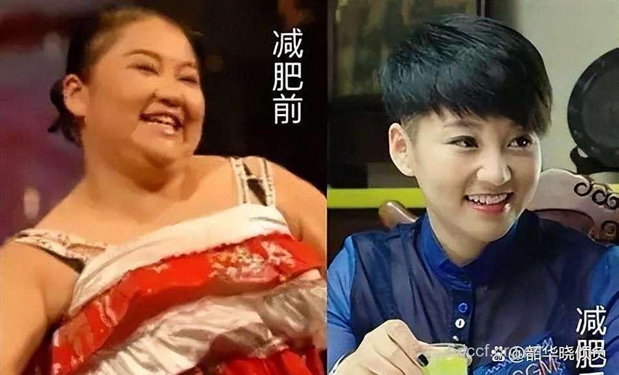 赵本山徒弟减重120斤 肥胖的七大危害