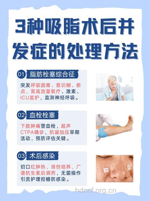 吸脂手术的13个并发症