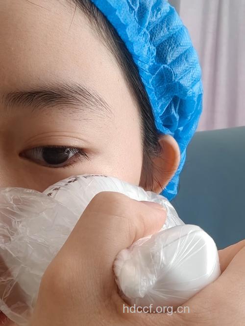 五大热门激光美肤效果点评